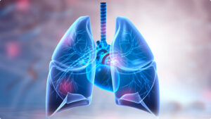 COPD Therapies